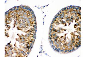 Immunohistochemistry (Paraffin-embedded Sections) (IHC (p)) image for anti-Transient Receptor Potential Cation Channel, Subfamily M, Member 5 (TRPM5) (AA 1021-1108) antibody (ABIN3044566)