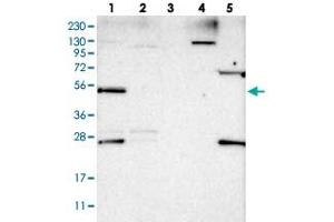 Western blot analysis of Lane 1: RT-4, Lane 2: U-251 MG, Lane 3: Human Plasma, Lane 4: Liver, Lane 5: Tonsil with DDX25 polyclonal antibody . (DDX25 抗体)