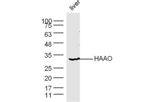HAAO Antikörper  (AA 101-200)