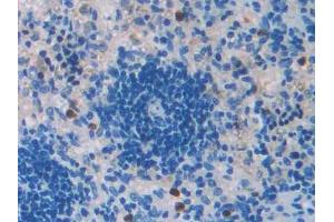 DAB staining on IHC-P; Samples: Rat Spleen Tissue (TGFB2 抗体  (AA 331-442))