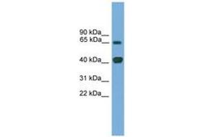 Image no. 1 for anti-LIM Homeobox Transcription Factor 1, alpha (LMX1A) (AA 251-300) antibody (ABIN6744615) (LMX1A 抗体  (AA 251-300))