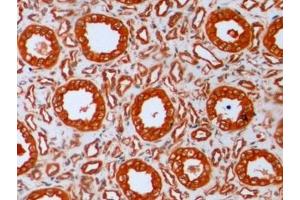 Immunohistochemistry (IHC) image for anti-Tubulin, beta (TUBB) (AA 170-419) antibody (ABIN7428962)