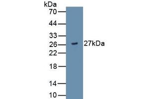 Detection of Recombinant ADAMTS9, Human using Monoclonal Antibody to A Disintegrin And Metalloproteinase With Thrombospondin 9 (ADAMTS9) (ADAMTS9 抗体  (AA 1727-1935))