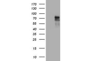 Image no. 6 for anti-Tumor Necrosis Factor Receptor Superfamily, Member 8 (TNFRSF8) (AA 19-379) antibody (ABIN1491085) (TNFRSF8 抗体  (AA 19-379))