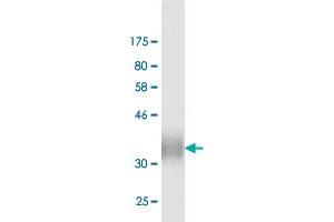 Western Blot detection against Immunogen (13. (PDCD1LG2 抗体  (AA 19-121))