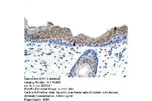 Rabbit Anti-SRAntibody  Paraffin Embedded Tissue: Human Skin Cellular Data: Squamous epithelial cells Antibody Concentration: 4. (SRP19 抗体  (Middle Region))