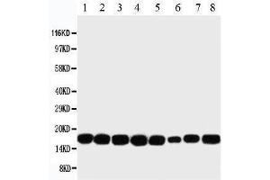Western Blotting (WB) image for anti-Non-Metastatic Cells 1, Protein (NM23A) Expressed in (NME1) (AA 137-152), (C-Term) antibody (ABIN3044197) (NME1 抗体  (C-Term))