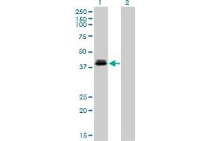 Western Blot analysis of OTX1 expression in transfected 293T cell line by OTX1 monoclonal antibody (M01), clone 1F2.