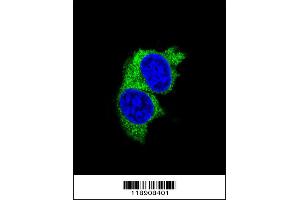 Confocal immunofluorescent analysis of MMP1 Antibody with MDA-MB231 cell followed by Alexa Fluor 488-conjugated goat anti-rabbit lgG (green). (MMP1 抗体  (AA 317-347))