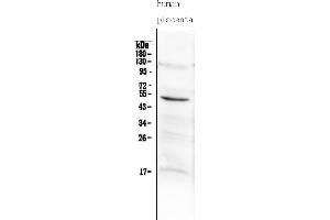 Western blot analysis of MMP10 using anti-MMP10 antibody (ABIN5519038). (MMP10 抗体  (AA 239-476))
