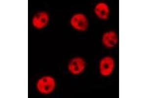 ABIN6278597 staining Hela by IF/ICC. (NOL8 抗体  (C-Term))