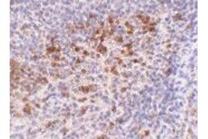 Immunohistochemistry of CAMP in human spleen tissue with CAMP polyclonal antibody  at 5 ug/mL .
