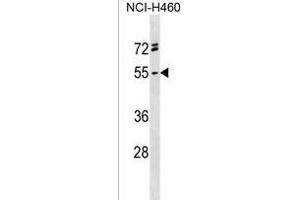 RG Antibody (C-term) (ABIN1537257 and ABIN2838199) western blot analysis in NCI- cell line lysates (35 μg/lane). (RGMA 抗体  (C-Term))