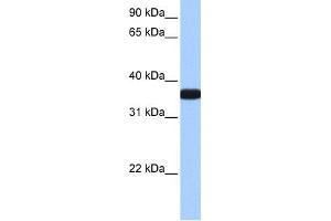 WB Suggested Anti-OCEL1 Antibody Titration:  0. (OCEL1 抗体  (C-Term))