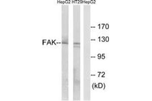 Western blot analysis of extracts from HepG2/HT-29 cells, using FAK (Ab-397) Antibody. (FAK 抗体  (AA 363-412))