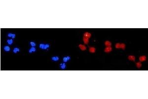 IF analysis of DDB2 using anti-DDB2 antibody (ABIN3043488). (DDB2 抗体  (AA 1-115))