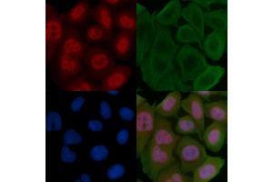 ABIN6255654 and ABIN6267462 staining Hela cells by IF/ICC. (Cyclin D3 抗体  (pThr283))