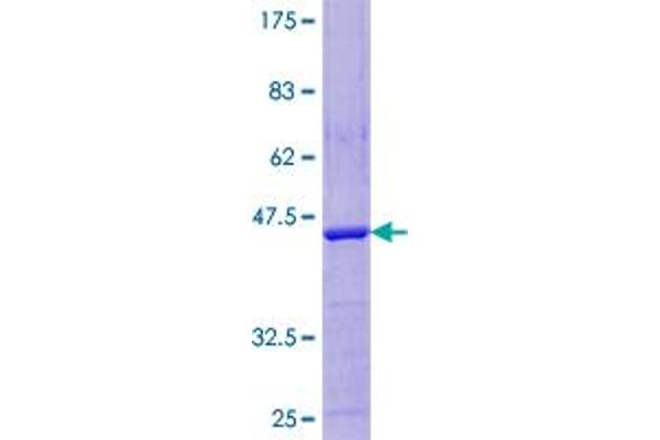 LDOC1 Protein (AA 1-146) (GST tag)