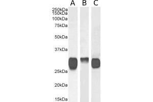 Western Blot using anti-HLA class II histocompatibility antigen DR antibody F3. (Recombinant HLA Class II 抗体)