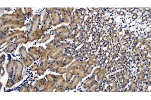 Detection of MyD88 in Mouse Kidney Tissue using Polyclonal Antibody to Myeloid Differentiation Factor 88 (MyD88) (MYD88 抗体  (AA 32-265))