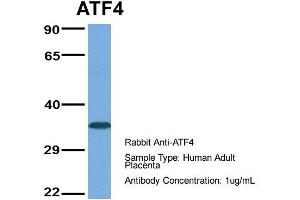 Western Blotting (WB) image for anti-Activating Transcription Factor 4 (Tax-Responsive Enhancer Element B67) (ATF4) (Middle Region) antibody (ABIN2792651)