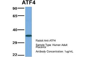 Host:  Rabbit  Target Name:  ATF4  Sample Type:  Human Adult Placenta  Antibody Dilution:  1. (ATF4 抗体  (Middle Region))