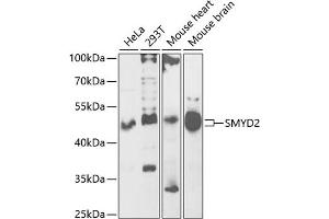 Western blot analysis of extracts of various cell lines, using SMYD2 antibody (ABIN6130910, ABIN6148167, ABIN6148168 and ABIN6222133) at 1:1000 dilution. (SMYD2A 抗体  (AA 1-270))