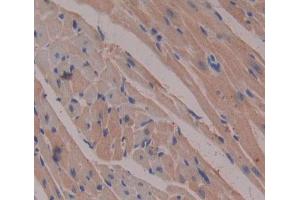 Used in DAB staining on fromalin fixed paraffin- embedded heart tissue (Esophageal Cancer Related Gene 4 (AA 32-148) 抗体)