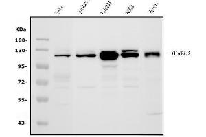 Western blot analysis of BubR1/BUB1B using anti-BubR1/BUB1B antibody (ABIN7600962). (BUB1B 抗体  (AA 26-448))