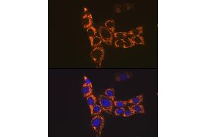 Immunofluorescence analysis of NIH-3T3 cells using H2-Ab1 Rabbit pAb (ABIN7267665) at dilution of 1:100 (40x lens). (H2-AB1 抗体)