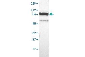 Western blot analysis of Human cell line RT-4 with PPFIBP2 polyclonal antibody  at 1:100-1:250 dilution. (PPFIBP2 抗体)