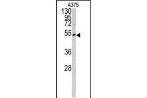 Western blot analysis of LUM antibody in A375 cell line lysates (35ug/lane) (LUM 抗体  (AA 198-227))