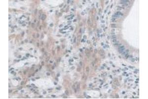 IHC-P analysis of Mouse Uterus Tissue, with DAB staining. (GLP1R 抗体  (AA 25-145))