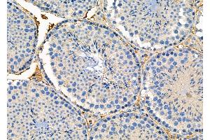 ABIN6260259 and ABIN6276294 at 1/100 staining Mouse testis tissue by IHC-P. (BID 抗体  (C-Term))