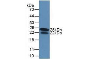 Detection of Recombinant IFNg, Human using Monoclonal Antibody to Interferon Gamma (IFNg) (Interferon gamma 抗体  (AA 24-166))