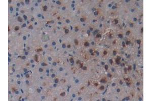 DAB staining on IHC-P; Samples: Rat Adrenal Gland Tissue (Osteopontin 抗体  (AA 17-317))