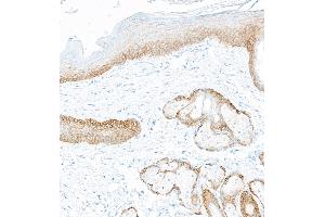 Immunohistochemistry (IHC) image for anti-Keratin 5 (KRT5) (C-Term) antibody (ABIN7795755) (Recombinant Cytokeratin 5 抗体  (C-Term))