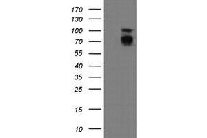 Image no. 6 for anti-Differentially Expressed in FDCP 6 Homolog (DEF6) antibody (ABIN1497808) (DEF6 抗体)