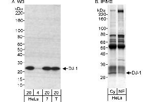 Immunoprecipitation (IP) image for anti-Parkinson Protein 7 (PARK7) (C-Term) antibody (ABIN7454672) (PARK7/DJ1 抗体  (C-Term))