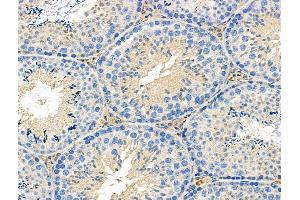 ABIN6258840 and ABIN6276280 at 1/100 staining Mouse testis tissue by IHC-P. (HCRTR1 抗体  (C-Term))