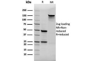 SDS-PAGE Analysis Purified Thyroglobulin Mouse Recombinant Monoclonal Antibody (rTGB24). (Recombinant Thyroglobulin 抗体)