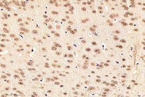 Immunohistochemistry analysis of paraffin-embedded mouse striatumusing,NOS1AP (ABIN7074844) at dilution of 1:4000 (NOS1AP 抗体)