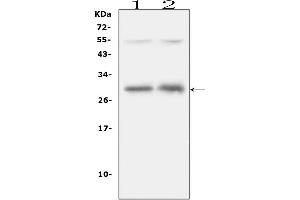 Western blot analysis of IL31 using anti-IL31 antibody (ABIN6719334).