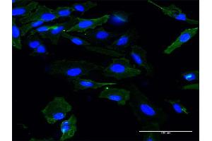 Immunofluorescence of monoclonal antibody to APOM on HeLa cell. (Apolipoprotein M 抗体  (AA 23-188))