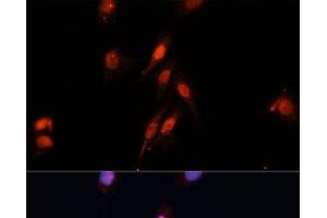 Immunofluorescence analysis of HeLa cells using Smad5 Polyclonal Antibody at dilution of 1:100 (40x lens). (SMAD5 抗体)