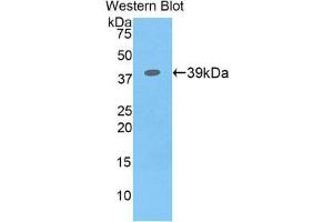 Western Blotting (WB) image for anti-Colony Stimulating Factor 2 Receptor, Beta (CSF2RB) (AA 133-233) antibody (ABIN3206477) (CD131 抗体  (AA 133-233))