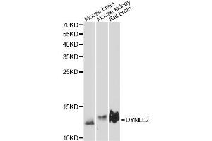 Western blot analysis of extracts of various cell lines, using DYNLL2 antibody (ABIN6292037) at 1:3000 dilution. (DYNLL2 抗体)