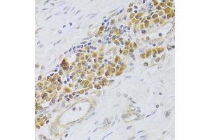 Immunohistochemistry of paraffin-embedded human esophagus using PA2G4 Antibody (ABIN5973112) at dilution of 1/100 (40x lens). (PA2G4 抗体)
