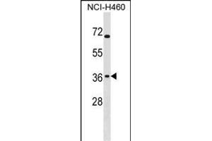 ST6GALNAC4 Antibody (C-term) (ABIN1536802 and ABIN2850365) western blot analysis in NCI- cell line lysates (35 μg/lane). (ST6GALNAC4 抗体  (C-Term))