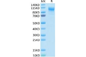 SDS-PAGE (SDS) image for Interleukin 31 Receptor A (IL31RA) (AA 20-519) protein (His tag) (ABIN7275018)
